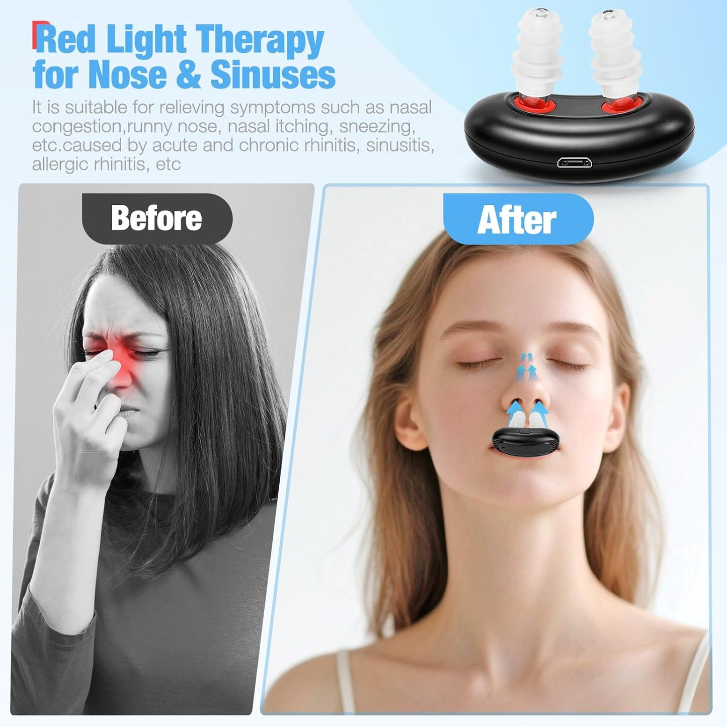 Nasal Therapy Device