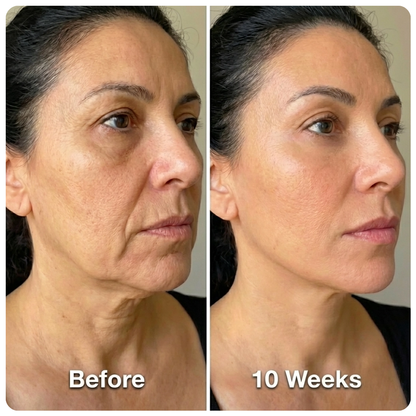 Velva™ Jaw Wrap