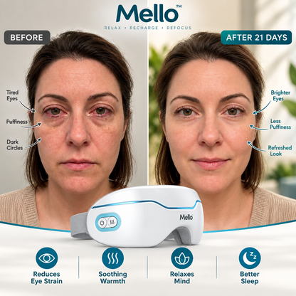 Mello™ Eye Steamer Pro