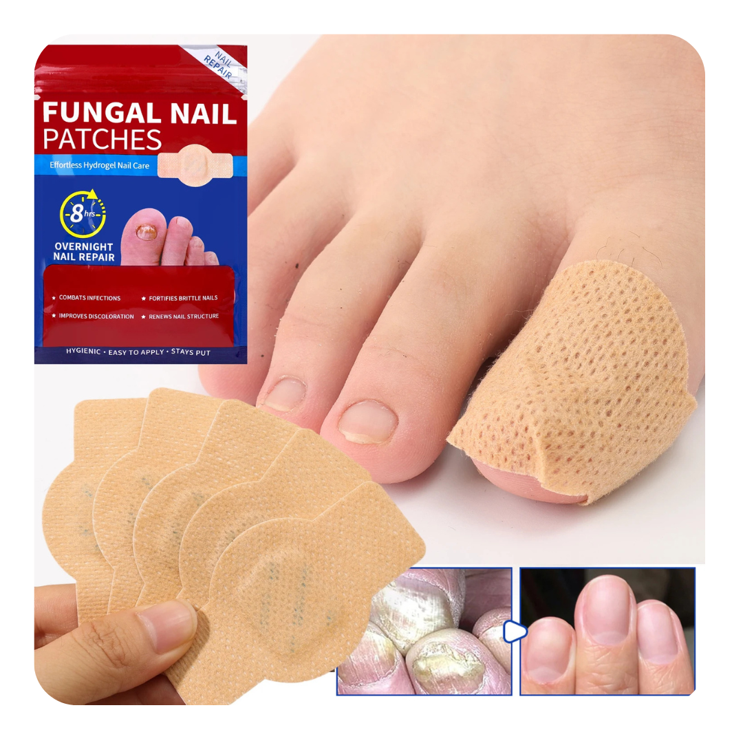 Fungal Nail Patches