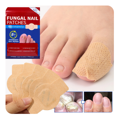 Fungal Nail Patches