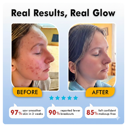 LED Face Therapy Mask
