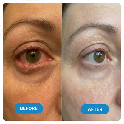 OptiMist Eye Comfort Pro