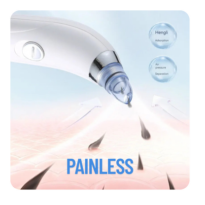 Electric Blackheads Remover Vecuum