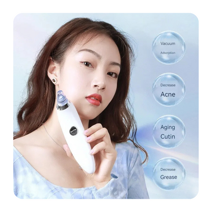 Electric Blackheads Remover Vecuum