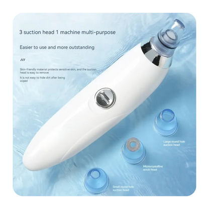 Electric Blackheads Remover Vecuum