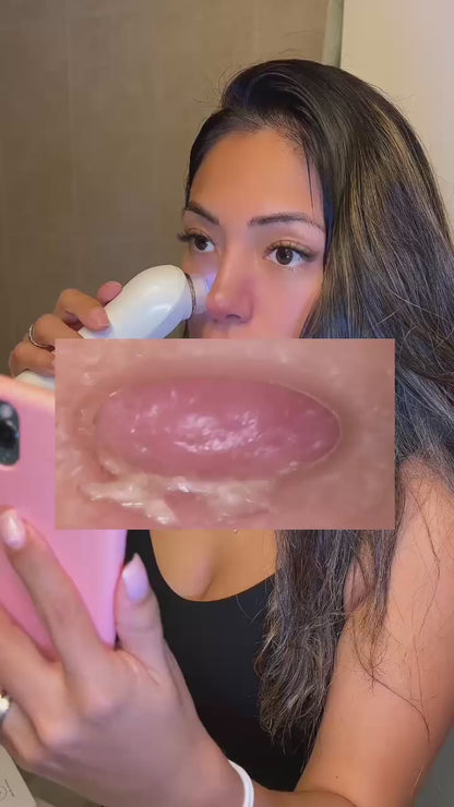 Electric Blackheads Remover Vecuum